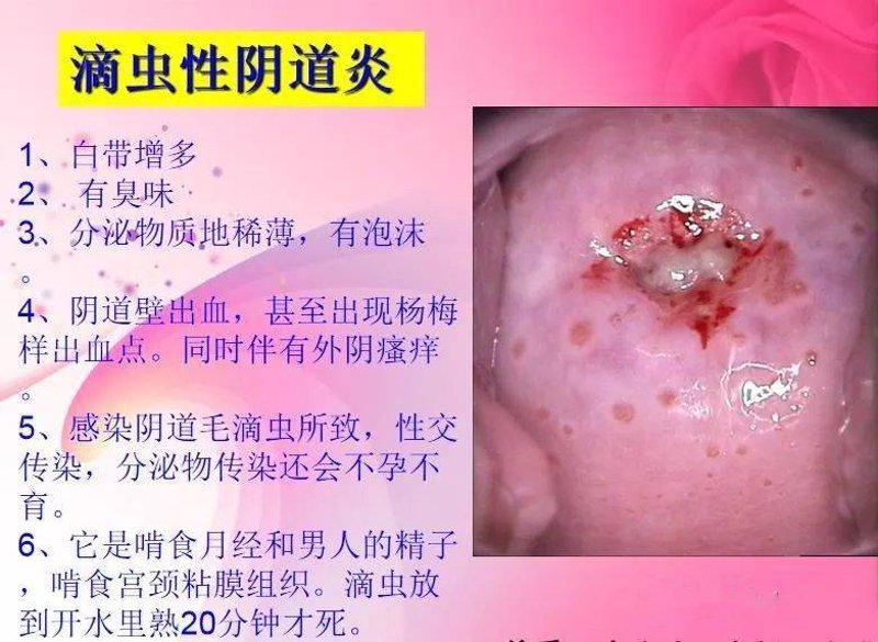 性功能障碍:10个常见症状揭示