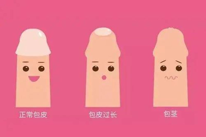 前列腺炎为何频发？听听医生怎么说