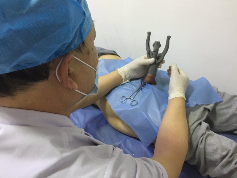 性功能障碍怎么恢复？男性朋友们常常为此烦恼不已。今天，我们就从专业角度出发，通过对比分析几种常见方法，帮助你找到合适的恢复途径。