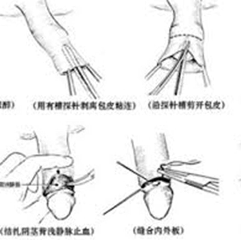 男科检查真的需要脱裤子吗？这个问题或许会让很多男性感到困惑甚至尴尬。今天，我们就通过故事叙述的方式揭开这个谜团。